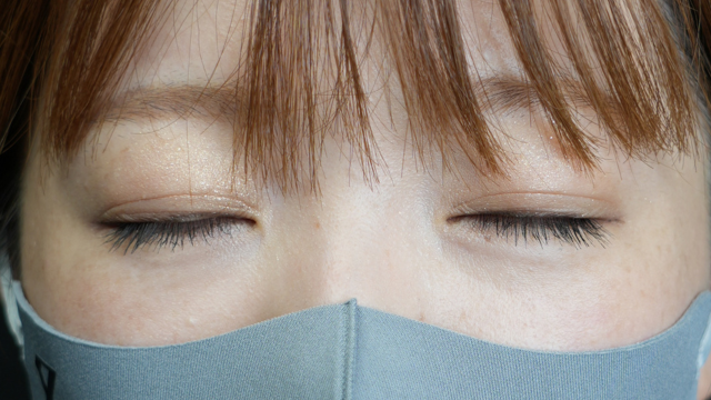 手术前的状态 其一