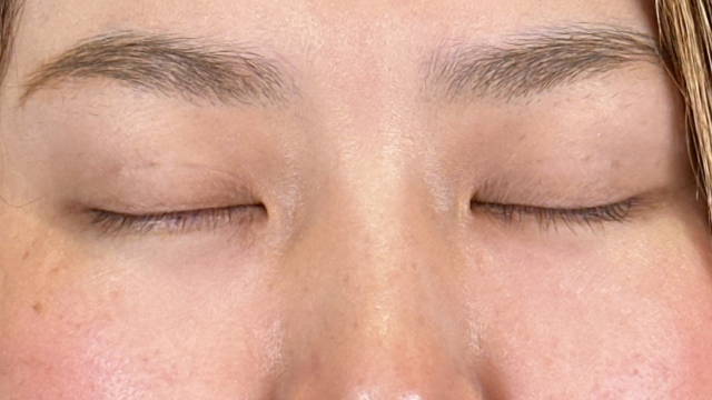 手术前的状态 其一