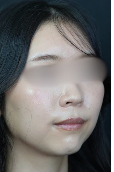 Postoperative Condition Part 1