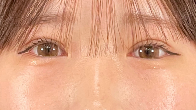 Postoperative Condition Part 1