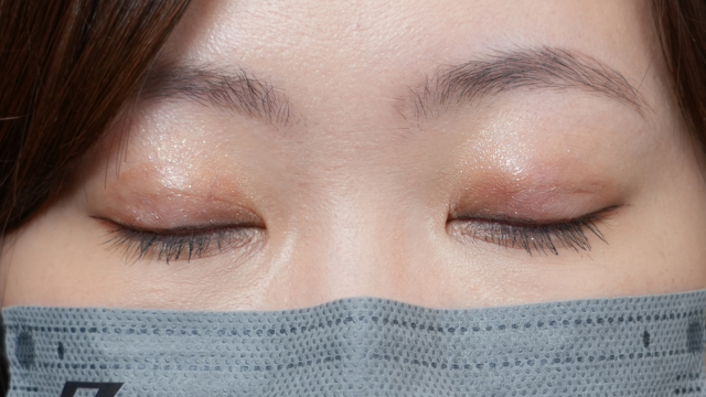 手術前の状態 その1