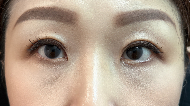 Postoperative Condition Part 1