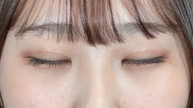 手术前的状态 其一