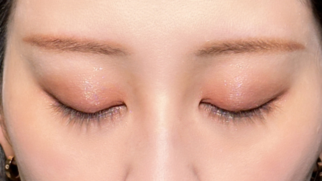 手术前的状态 其一