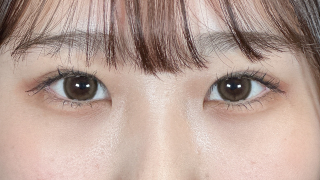 手术前的状态 其一