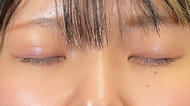 手术前的状态 其一