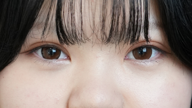 手术前的状态 其一