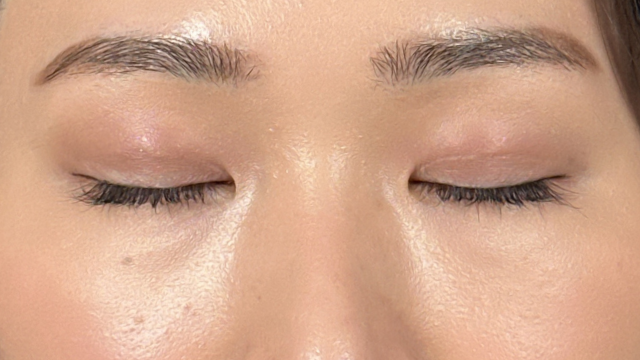 手術前の状態 その1