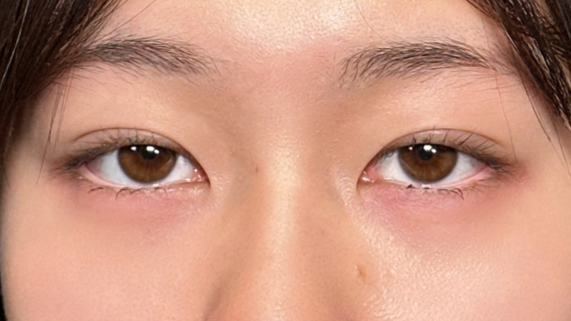 手术前的状态 其一