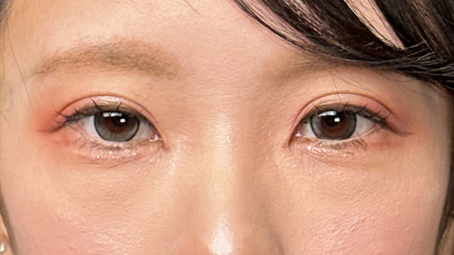 手术前的状态 其一