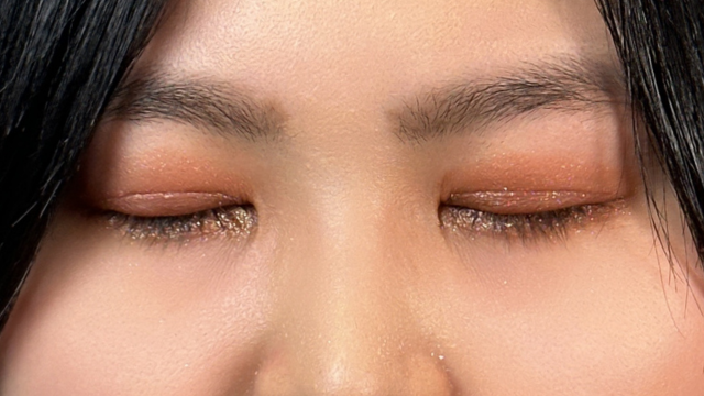 手术前的状态 其一