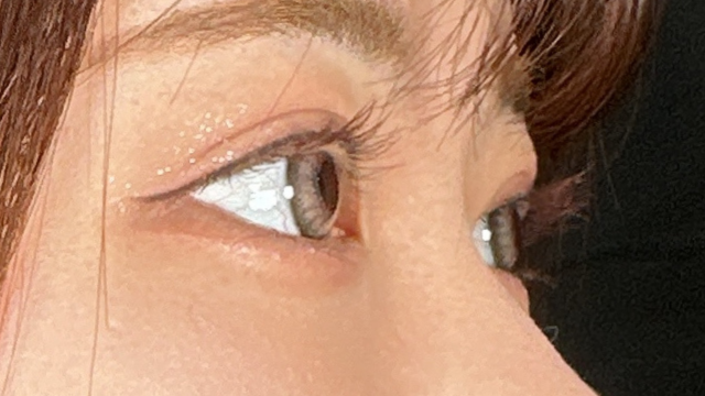 手术前的状态 其一