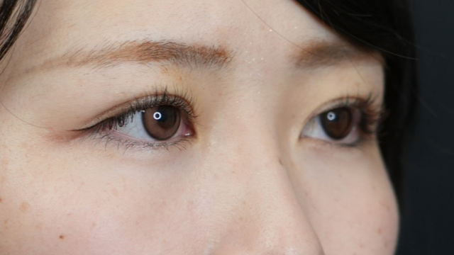 手术前的状态 其一