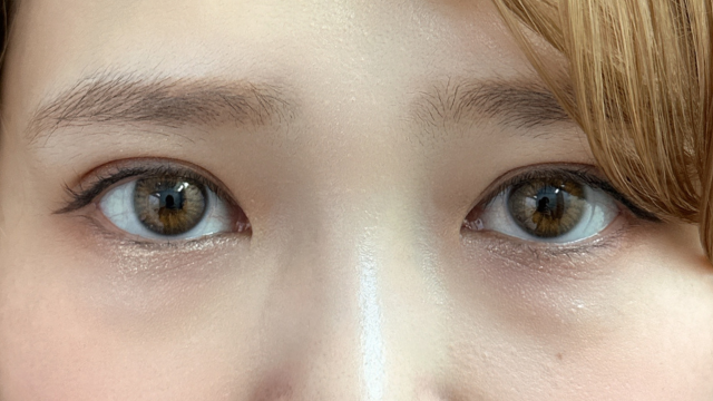 手术前的状态 其一