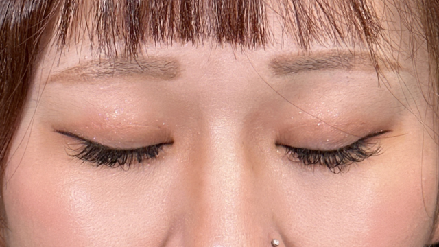 手术前的状态 其一