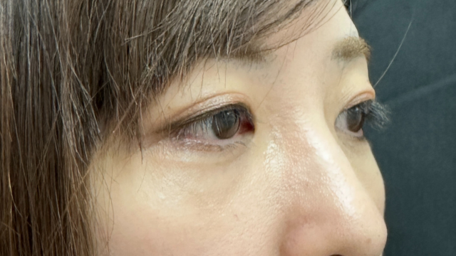 手术前的状态 其一