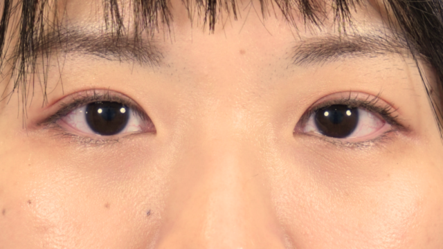 Postoperative Condition Part 1