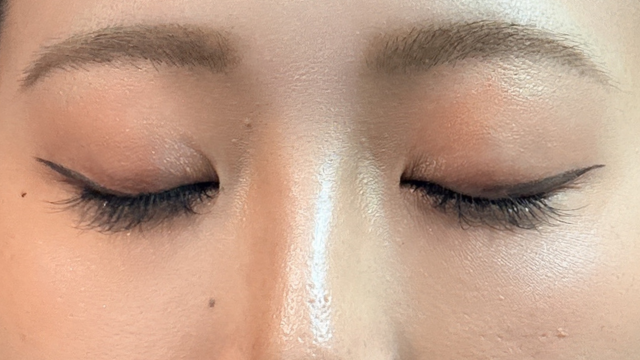 手術前の状態 その1