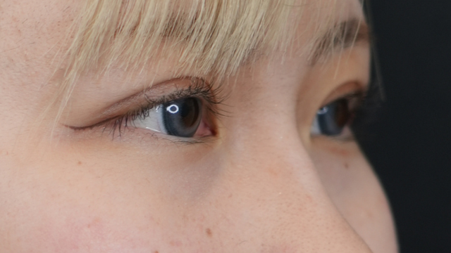 手术前的状态 其一