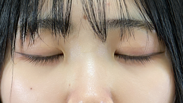 Postoperative Condition Part 1