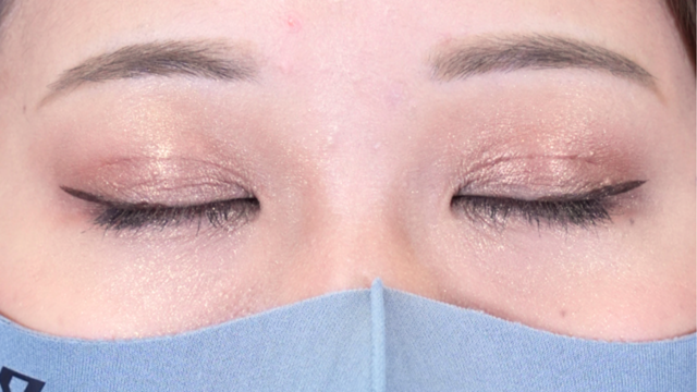 手術前の状態 その1