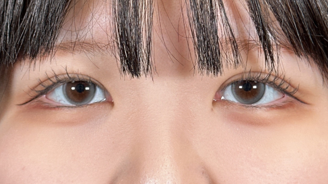 手术前的状态 其一