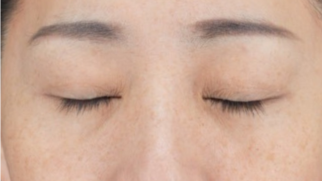 手术前的状态 其一