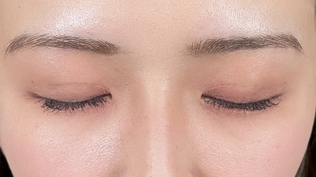 手术前的状态 其一