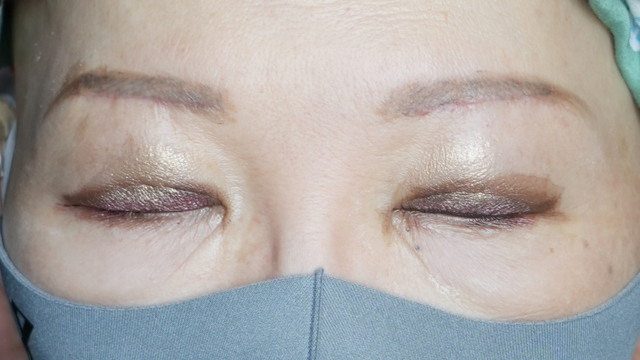 Postoperative Condition Part 1