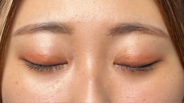 手術前の状態 その1