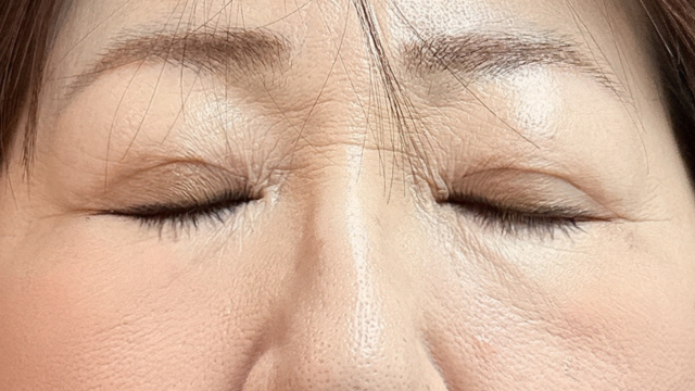 手术前的状态 其一