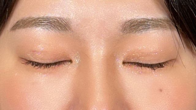 手術前の状態 その1