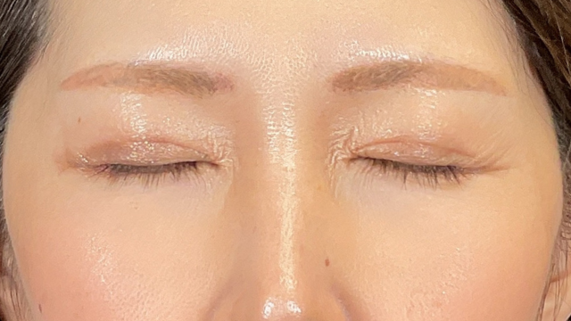 Postoperative Condition Part 1