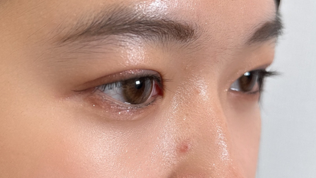 手术前的状态 其一