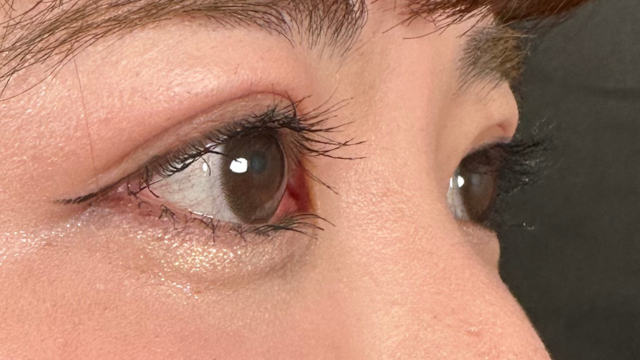 手术前的状态 其一