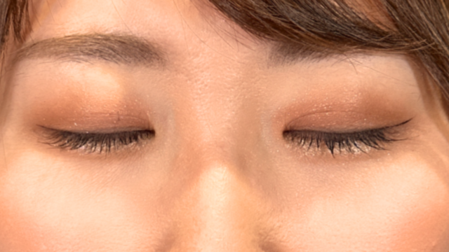 手术前的状态 其一