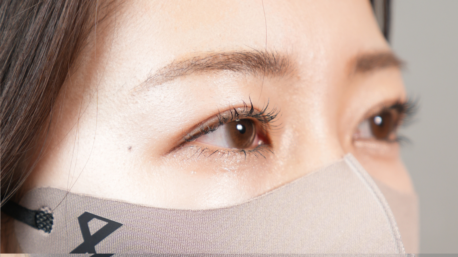 手術前の状態 その1