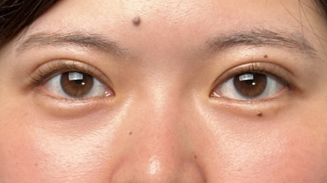 手术前的状态 其一