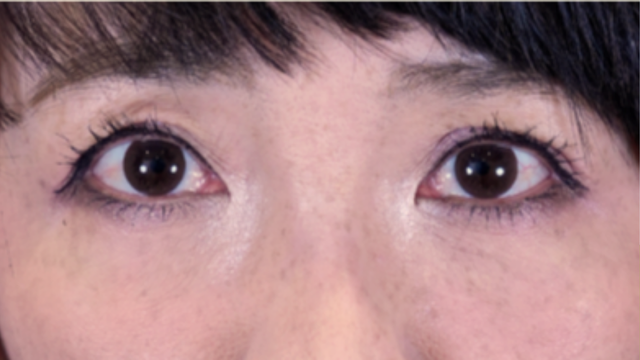 手术前的状态 其一