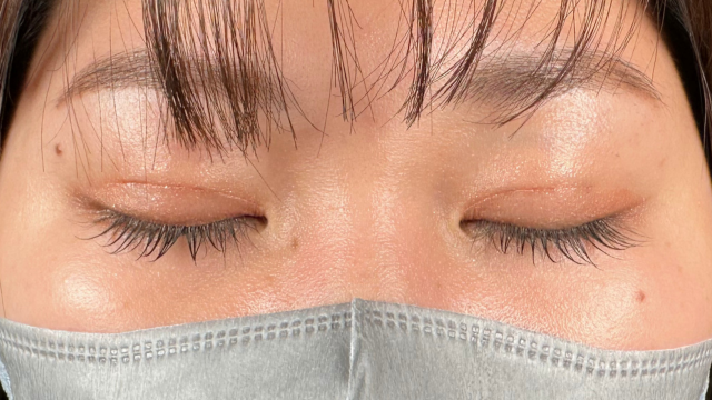 Postoperative Condition Part 1