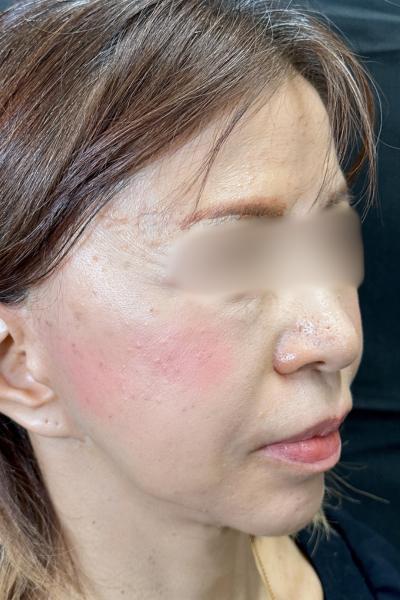 手術前の状態 その1