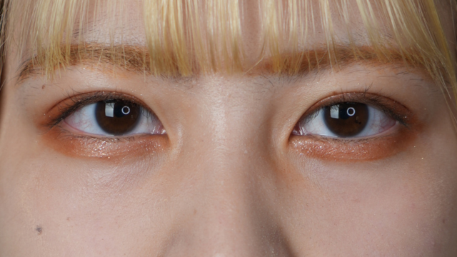 手術前の状態 その1