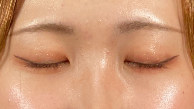 手术前的状态 其一