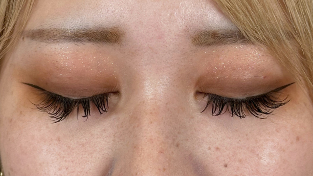 Postoperative Condition Part 1