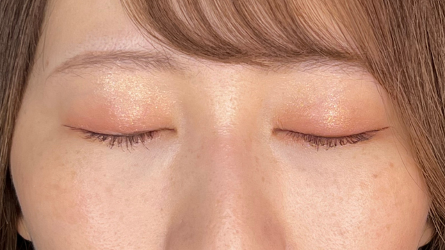 手术前的状态 其一