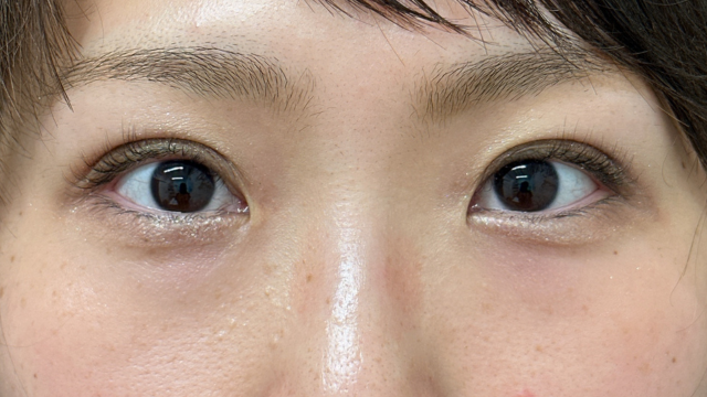 手术前的状态 其一