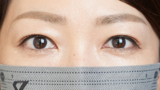 手术前的状态 其一