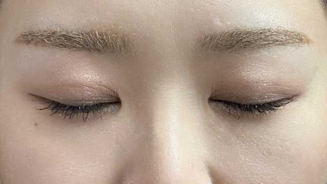 手术前的状态 其一