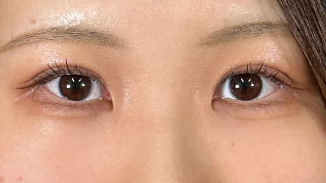 手术前的状态 其一