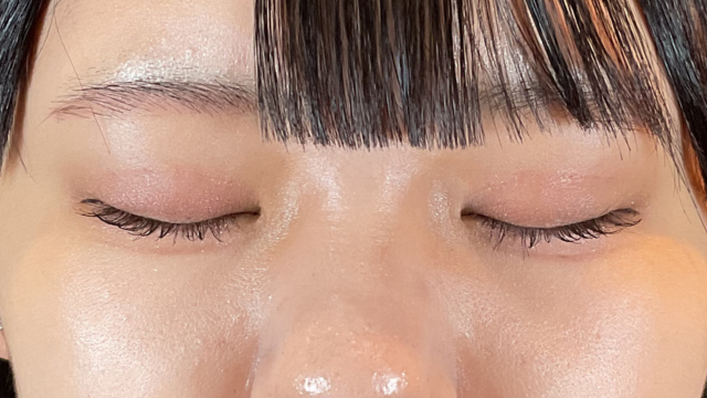 Postoperative Condition Part 1